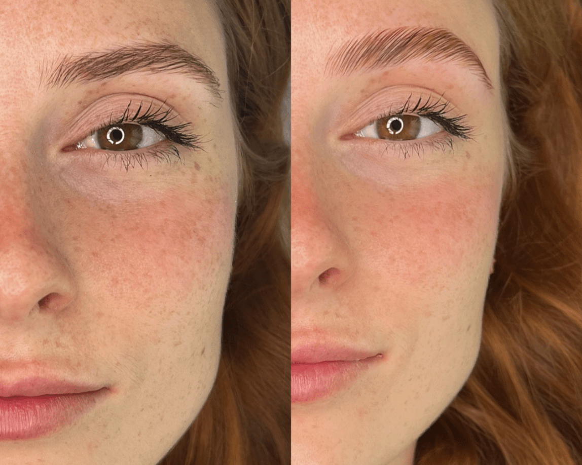 Brow Lamination